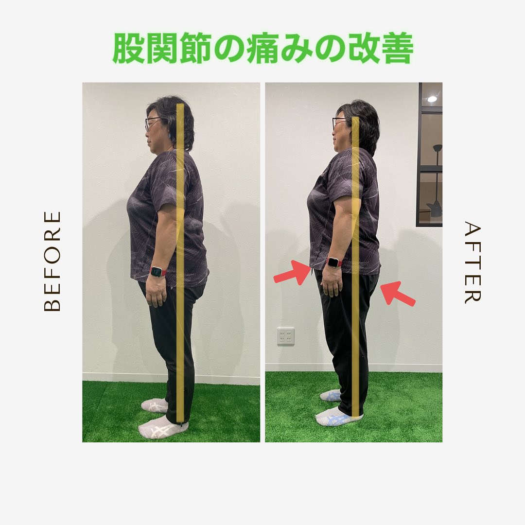立ち仕事での股関節の痛み、諦めていませんか?page-visual 立ち仕事での股関節の痛み、諦めていませんか?ビジュアル