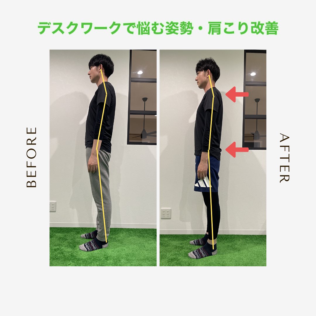 「いつものコリ」が「痛み」に変わる前に!page-visual 「いつものコリ」が「痛み」に変わる前に!ビジュアル