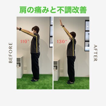「腕が上がらない」肩の悩み、2回目でここまでの経過page-visual 「腕が上がらない」肩の悩み、2回目でここまでの経過ビジュアル
