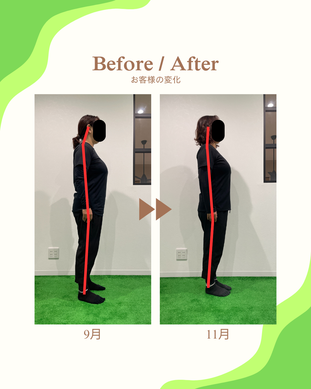 【つくば】整体×パーソナルトレーニング：姿勢改善「Before/After◇【デスクワーク症候群】長年の「ストレートネック・スマホ首」とサヨナラ！」page-visual 【つくば】整体×パーソナルトレーニング：姿勢改善「Before/After◇【デスクワーク症候群】長年の「ストレートネック・スマホ首」とサヨナラ！」ビジュアル